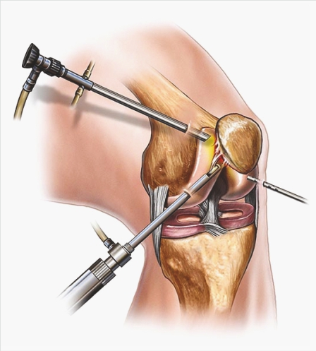 Arthroscopy anatomy illustration