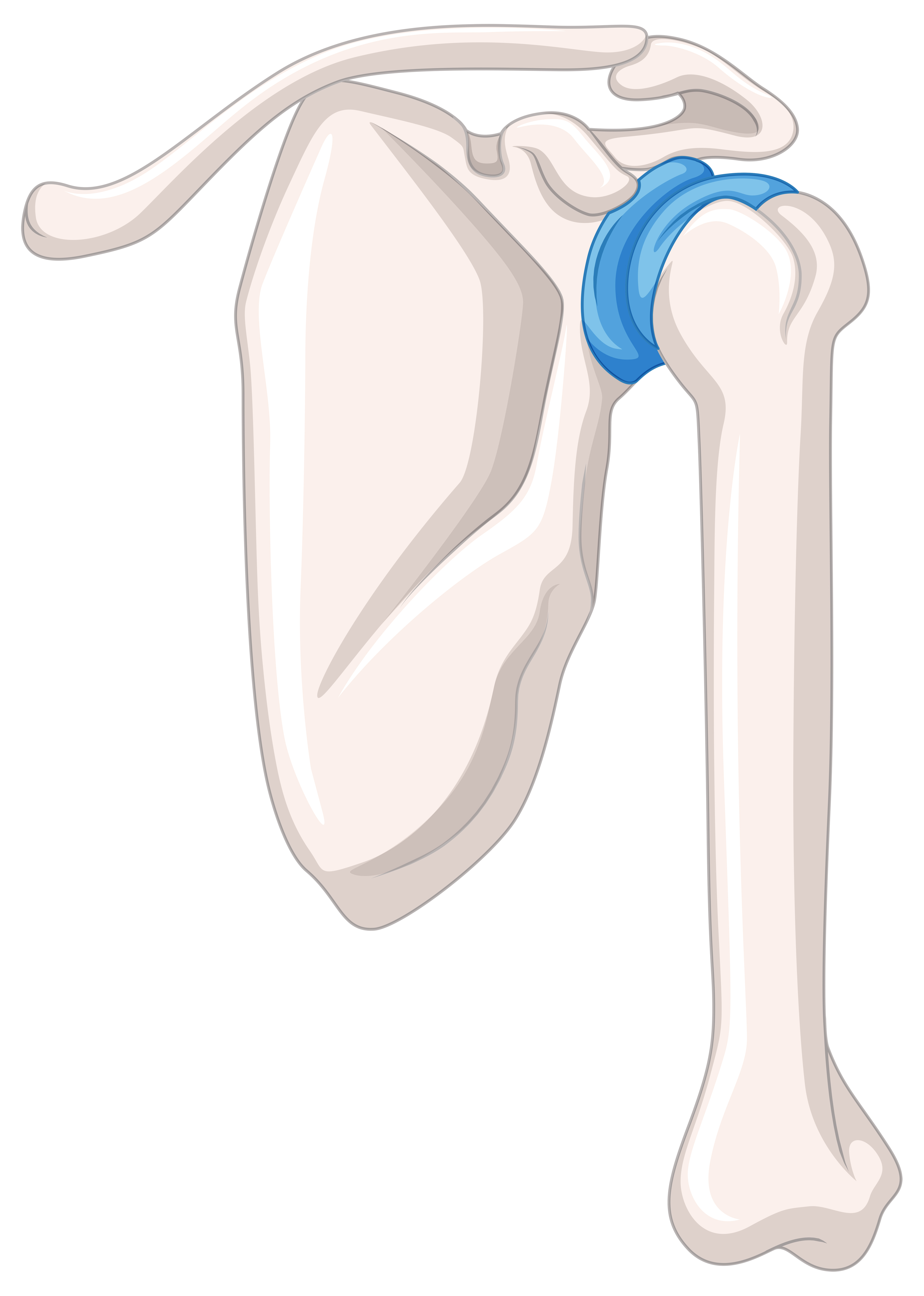 Shoulder Replacement anatomy illustration