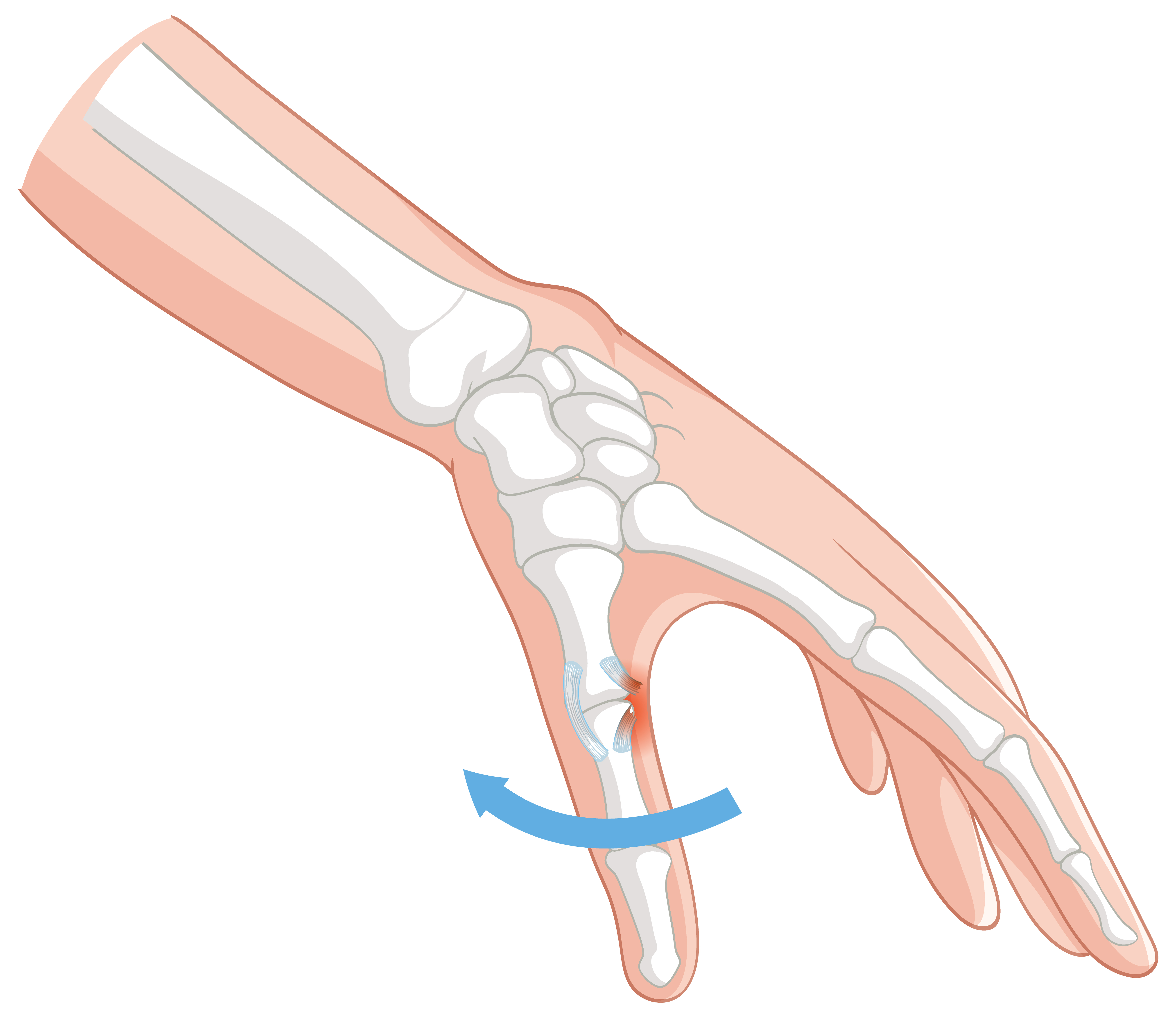 Trauma and Fracture Surgery anatomy illustration